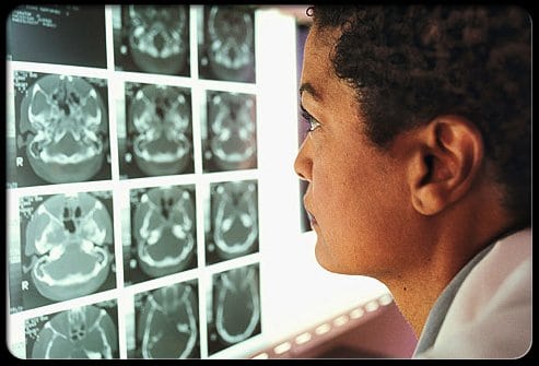 personal injury lawyer utah concussion