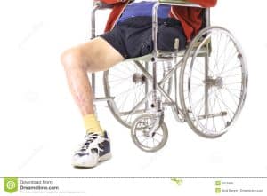 pic-amputation amputation personal injury lawyer utah