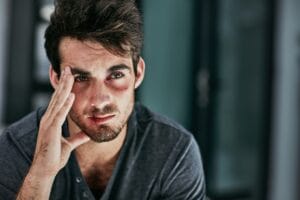 Emotional Trauma in Personal Injury Cases Emotional Trauma in Personal Injury Cases